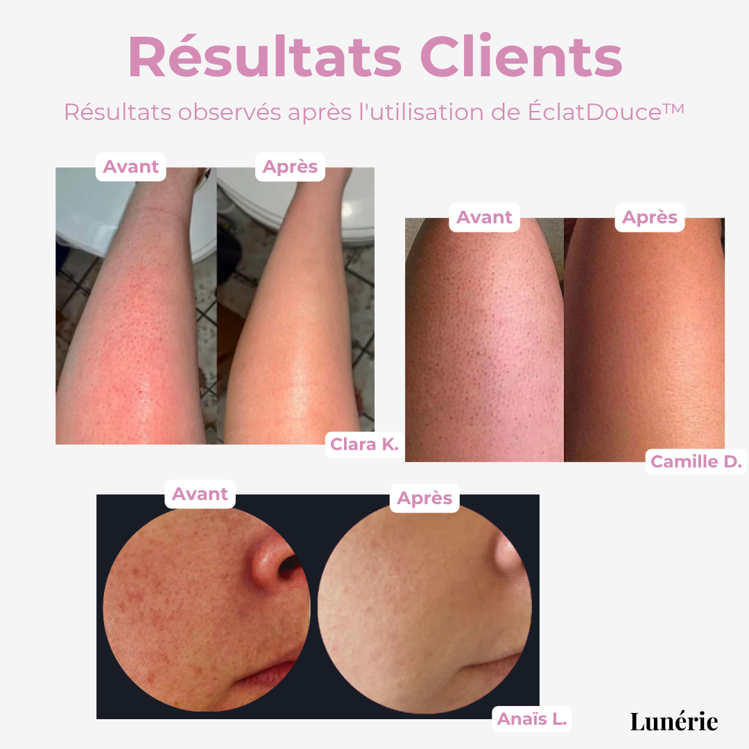 1 + 2 GRATUIT | ÉclatDouce™ Éponge Exfoliante pour le Corps