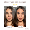 Dernier Jour -50% | SkinBlend™ Palette Correctrice 3-en-1