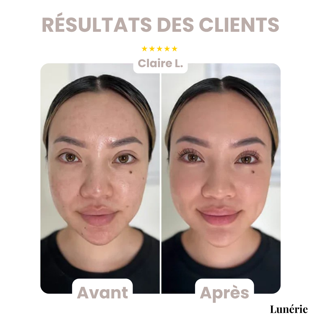 Dernier Jour -50% | SkinBlend™ Palette Correctrice 3-en-1
