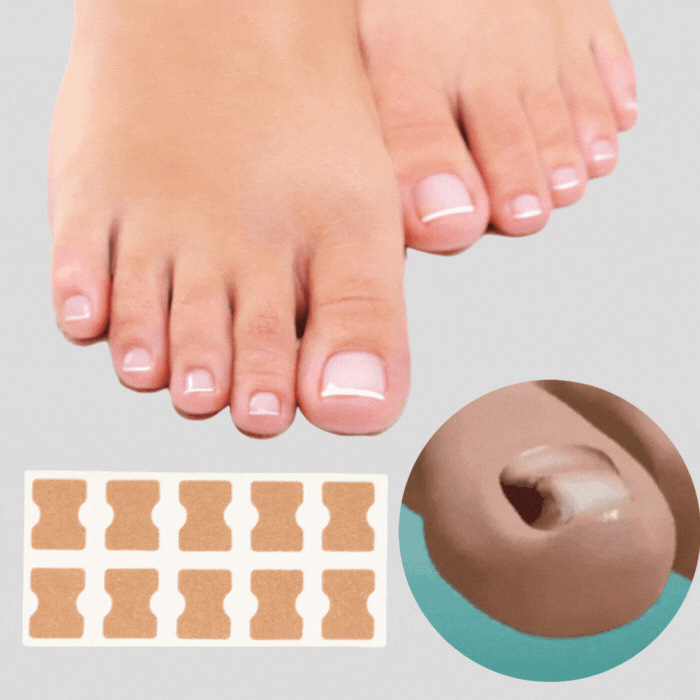 Dernier Jour -50% | PediPatch™ Patches de correction des ongles (100 pièces)