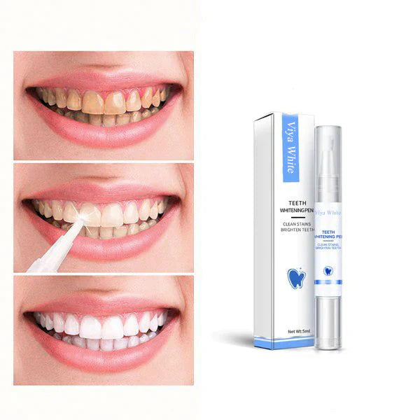 GlowDent™ Stylo blanchissant pour les dents