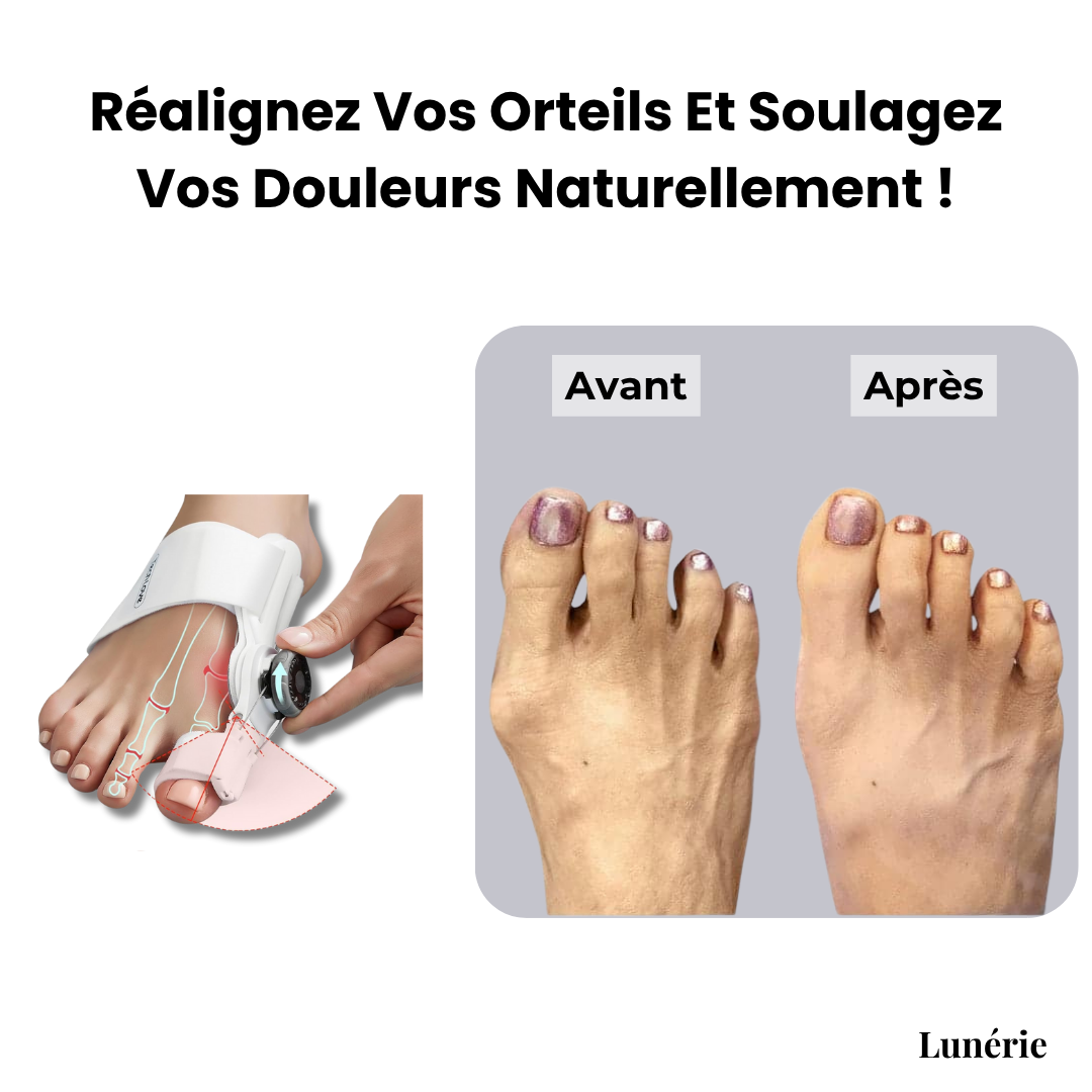 Dernier Jour -50% | ToeAlign™ Correcteur pour Hallux Valgus