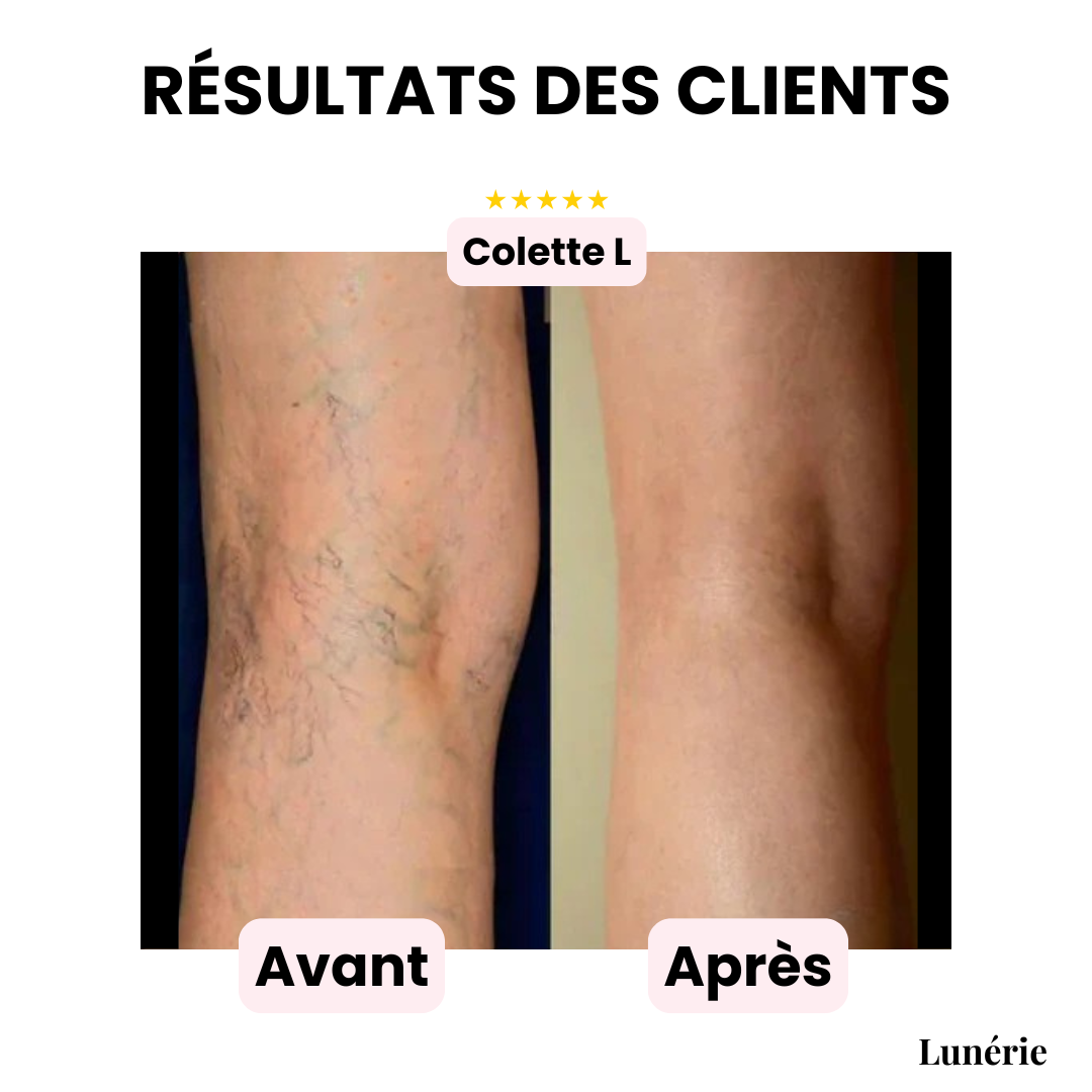 Dernier Jour -50% | CoverLuxe™ Fond de teint corps haute couvrance