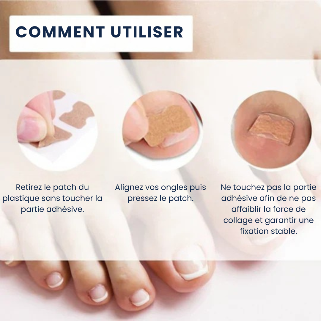 Dernier Jour -50% | PediPatch™ Patches de correction des ongles (100 pièces)