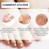 Dernier Jour -50% | PediPatch™ Patches de correction des ongles (100 pièces)