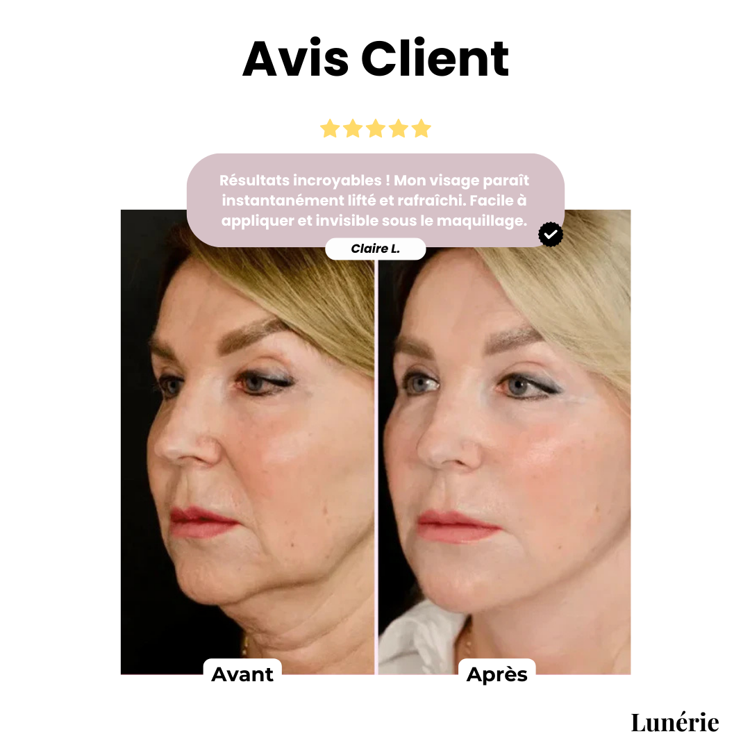 Dernier Jour -50%🔥 | GlowLift™ Bande Lifting Visage Invisible (40 patchs)