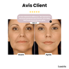 Dernier Jour -50%🔥 | GlowLift™ Bande Lifting Visage Invisible (40 patchs)
