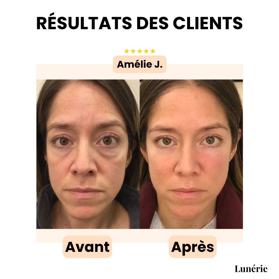 Dernier Jour -50% | YouthGlow™ Crème anti-rides pour les yeux