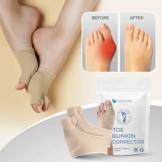 Dernier Jour -50% | ToeRelief™ Correcteur d’Oignon Sans Chirurgie