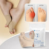 Dernier Jour -50% | ToeRelief™ Correcteur d’Oignon Sans Chirurgie