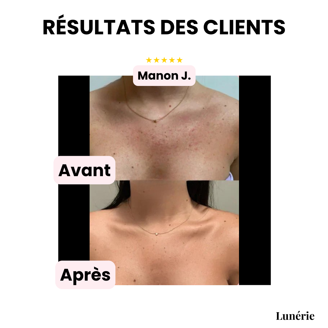 Dernier Jour -50% | CoverLuxe™ Fond de teint corps haute couvrance