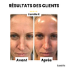Dernier Jour -50% | SkinLift™ Masque Collagène Liftant