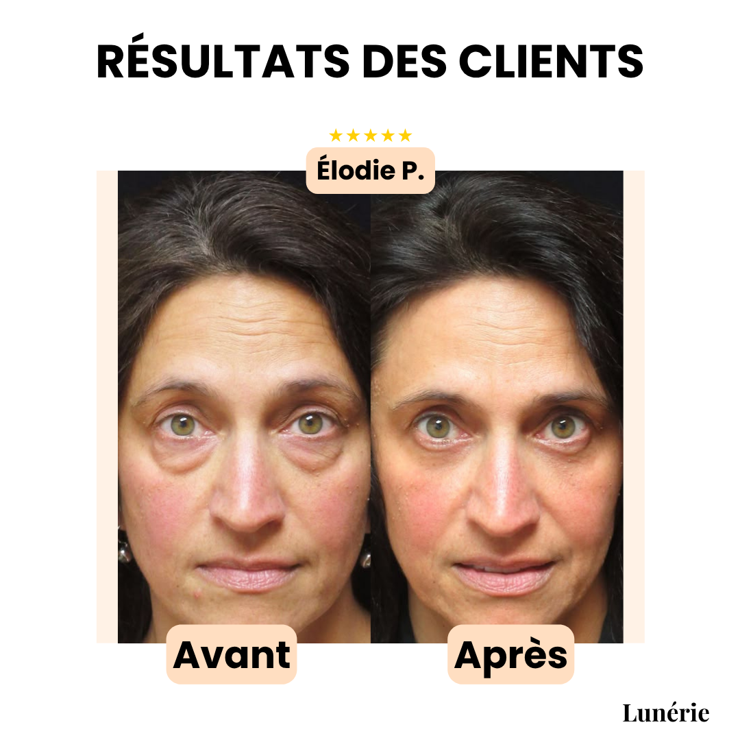 Dernier Jour -50% | YouthGlow™ Crème anti-rides pour les yeux