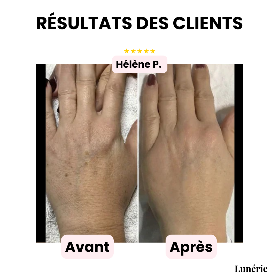 Dernier Jour -50% | CoverLuxe™ Fond de teint corps haute couvrance