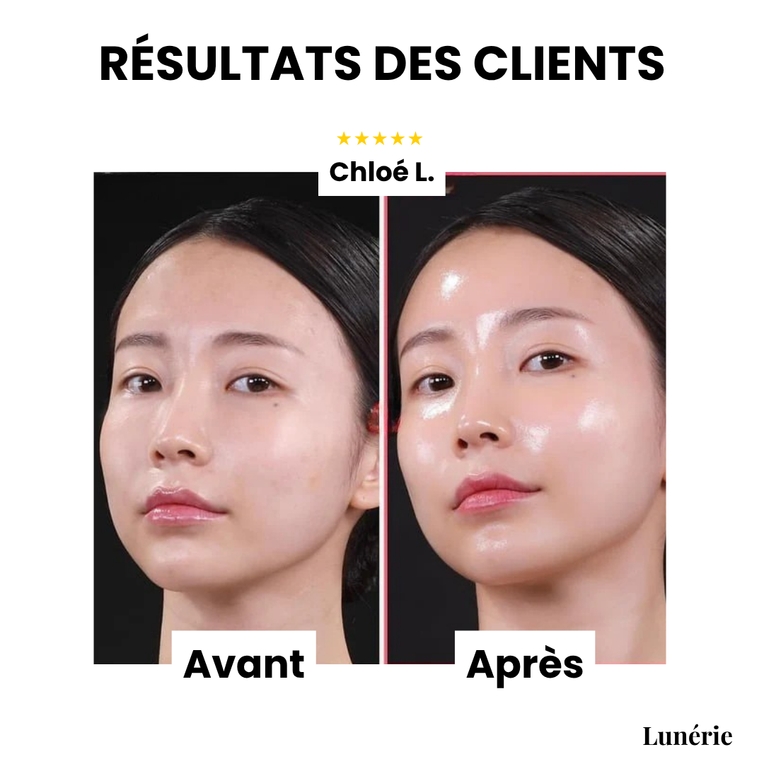Dernier Jour -50% | SkinLift™ Masque Collagène Liftant