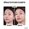 Dernier Jour -50% | SkinLift™ Masque Collagène Liftant
