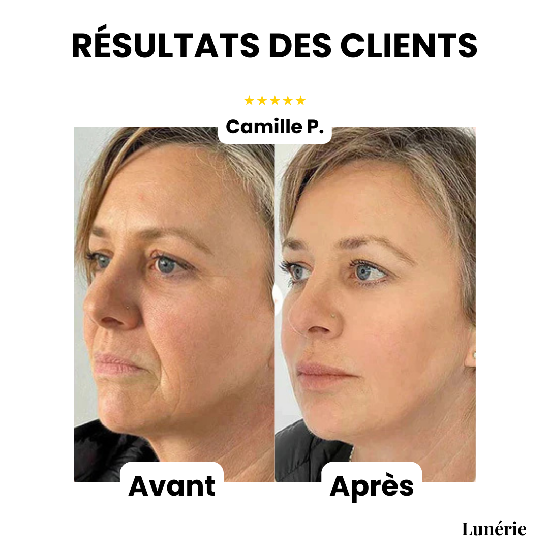 Dernier Jour -50% | GlowLuxe™ Baume Anti-Rides