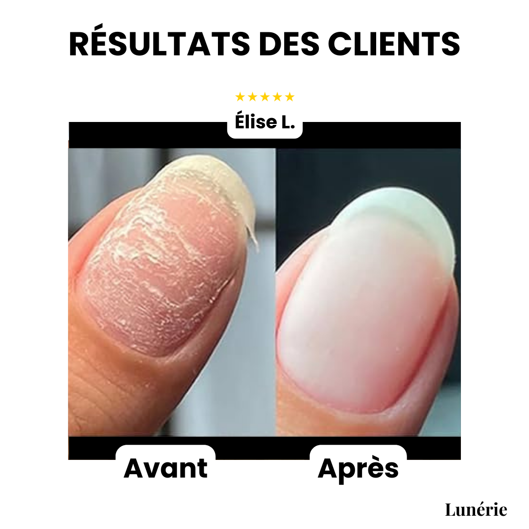 Dernier Jour -50 % | NailVive™ Gel Réparateur pour Ongles