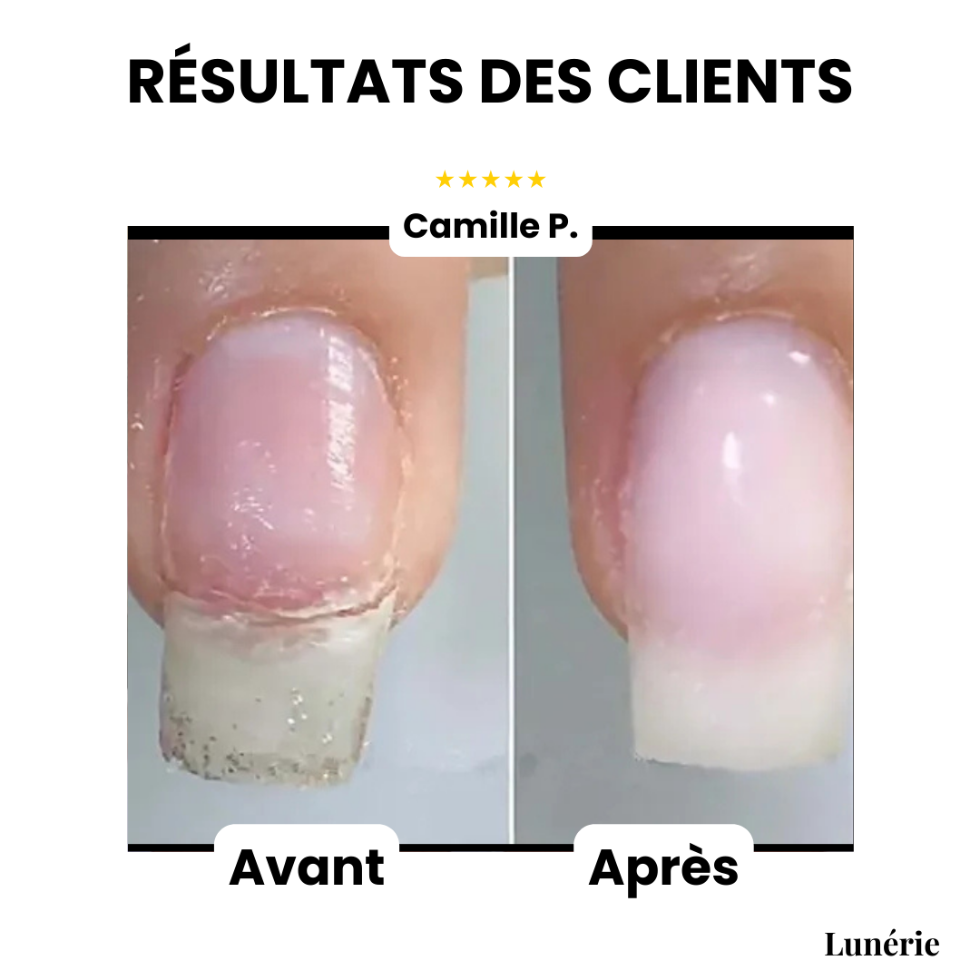 Dernier Jour -50 % | NailVive™ Gel Réparateur pour Ongles