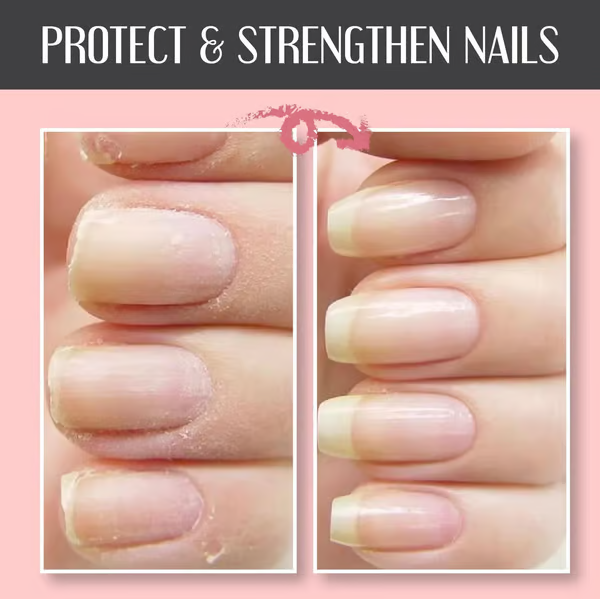 Dernier Jour -50 % | NailVive™ Fini les Ongles Cassés !
