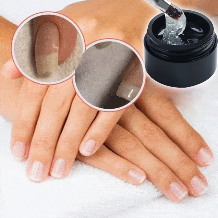 Dernier Jour -50 % | NailVive™ Fini les Ongles Cassés !