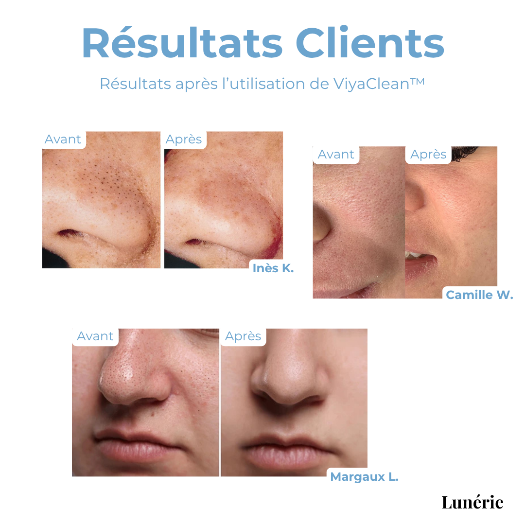 5+5 GRATUIT | ViyaClean™ Sérum Nettoyant pour les Pores