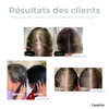 Dernier Jour -50% | RéviScalp™ - Masseur Stimulateur de Repousse Capillaire