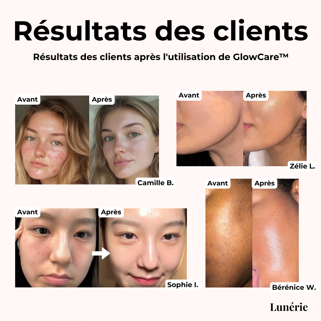 Dernier Jour -50%🔥 | GlowCare™ Masque de Nuit au Collagène