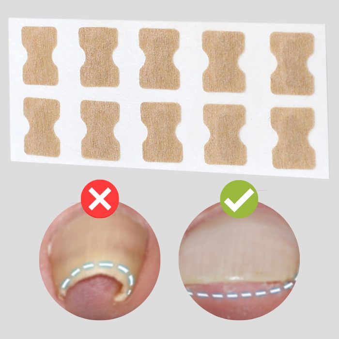 Dernier Jour -50% | PediPatch™ Patches de correction des ongles (100 pièces)