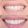 GlowDent™ Stylo blanchissant pour les dents