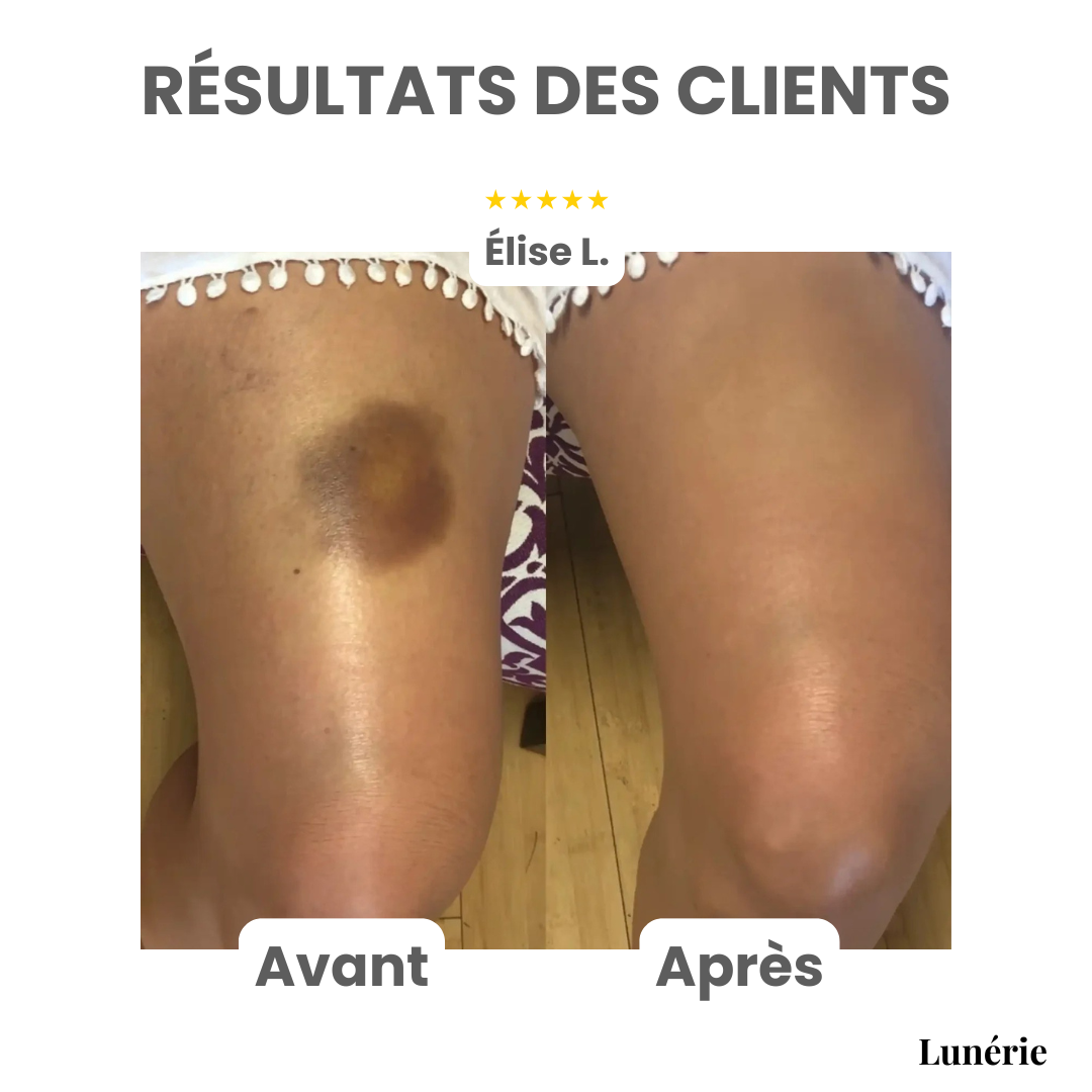 Dernier Jour -50% | GlowEase™ Crème Soin Perfectrice 3-en-1