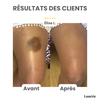 Dernier Jour -50% | GlowEase™ Crème Soin Perfectrice 3-en-1